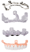 Implant Restoration